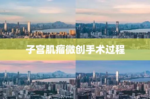 子宮肌瘤微創手術過程